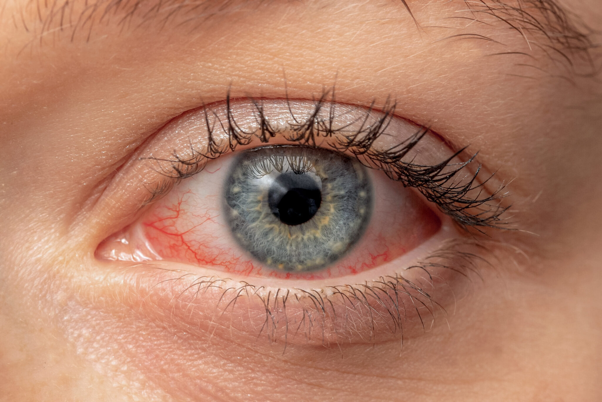 Инновационные средства для лечения глаз
